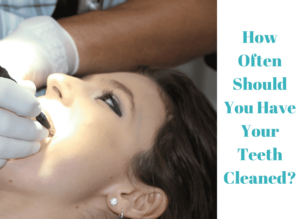 How Often Should You Have Your Teeth Cleaned?